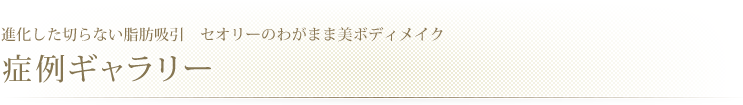 進化した切らない脂肪吸引 セオリークリニックのわがまま美ボディメイク症例ギャラリー