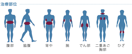 治療部位