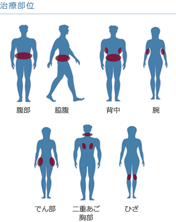 治療部位